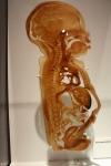 Cross Section of infant